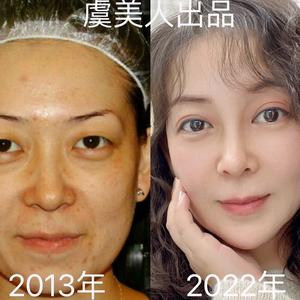 宁夏虞美人金牌服务网点-极品女人媛姐